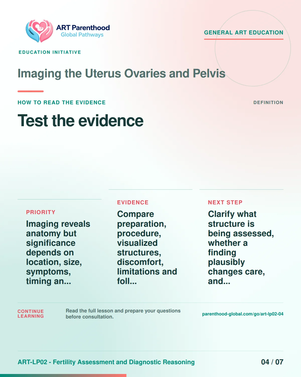 Slide 4 of ART-LP02-04 presents an accessible process map for imaging the uterus ovaries and pelvis and its decision boundaries.